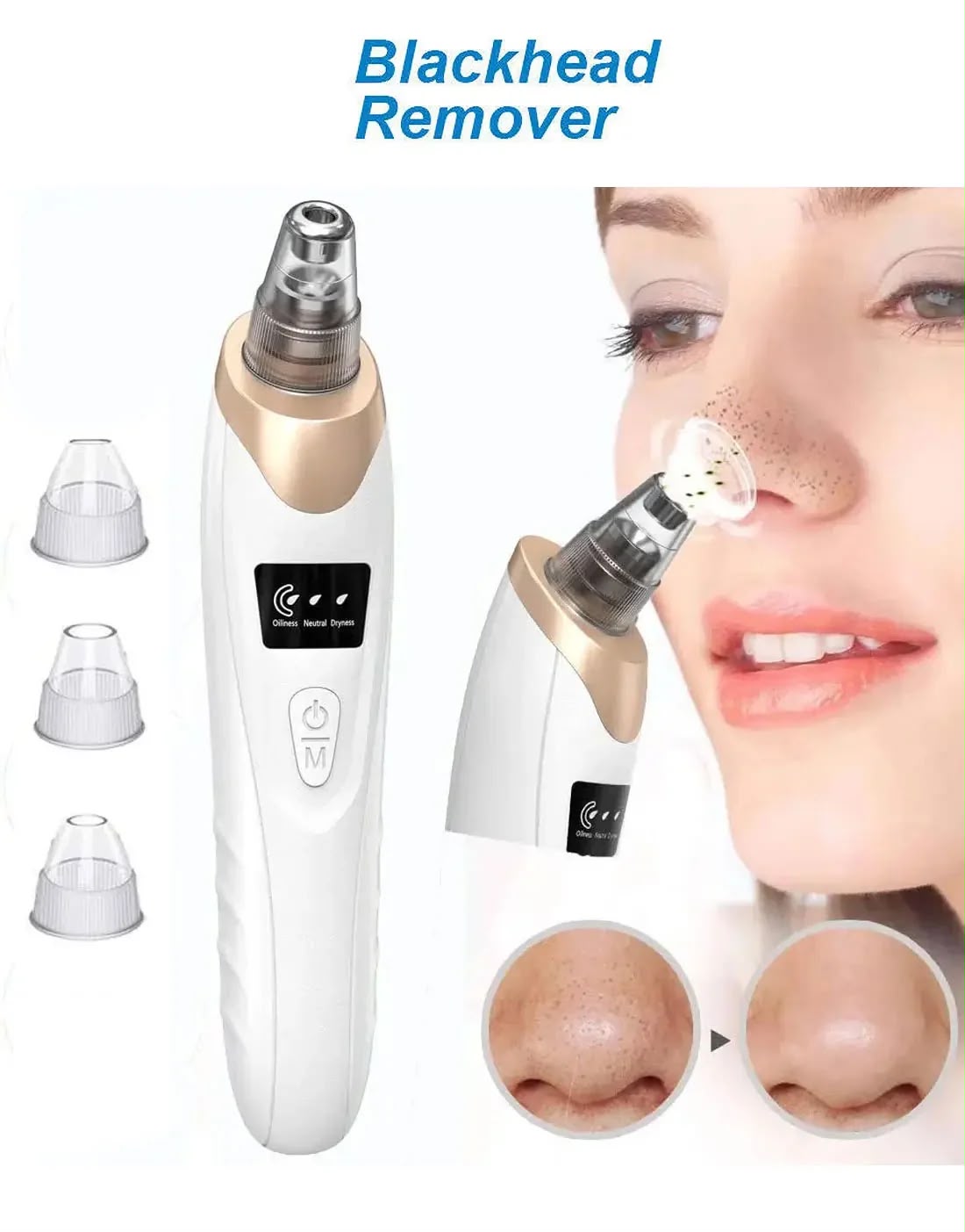 Blackhead Remover Vacuum Pore Cleaner – Electric Facial Acne & Blackhead Removal Device with 5 Suction Heads